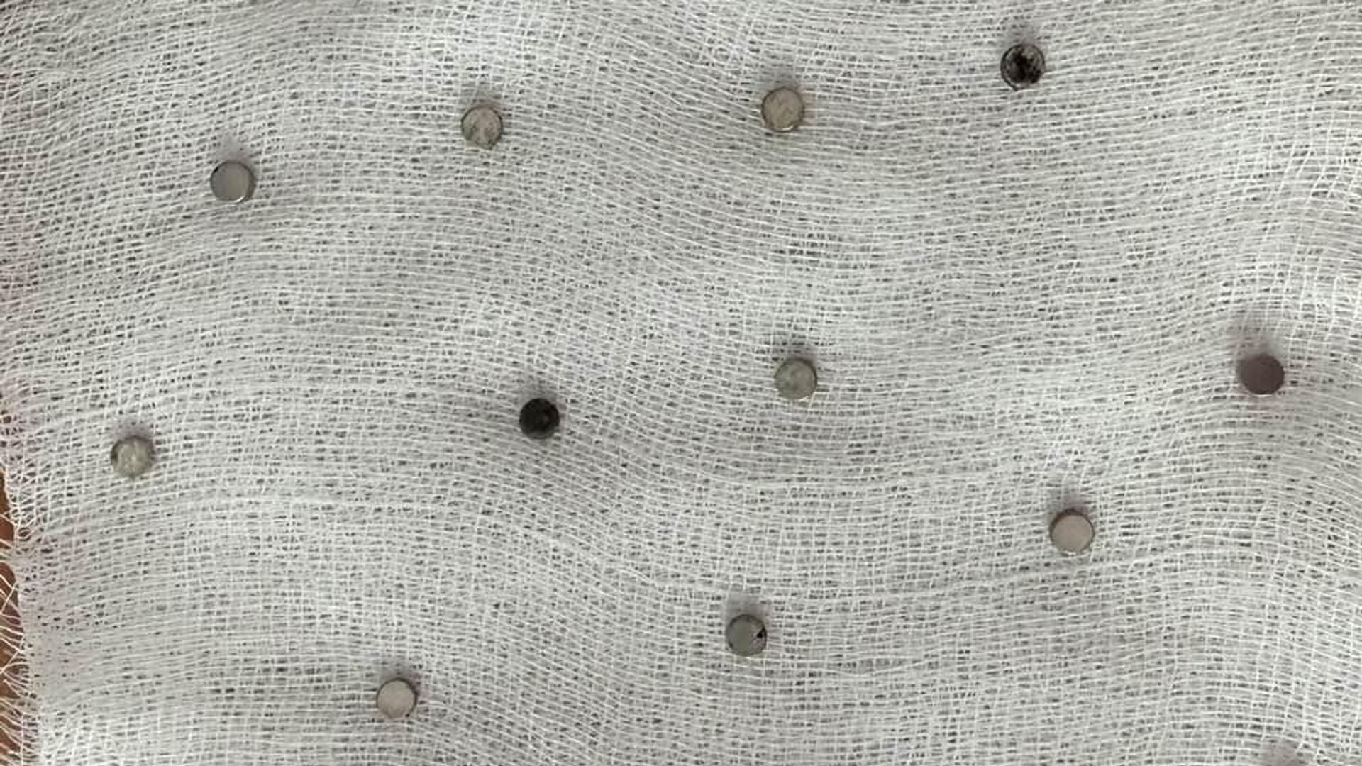 toplam 19 miknatis yemek borusundan cikarildi LLeYESTD